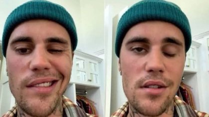 Justin Bieber reappears after suffering from facial paralysis and smiles again | Marca