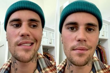 Justin Bieber shares update after revealing face is paralyzed