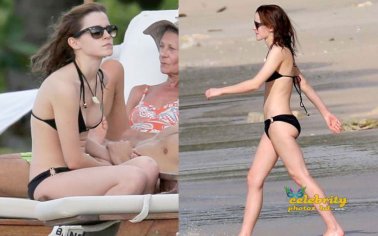 Emma Watson Unseen Hot Bikini Photos