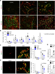 Biliary NIK promotes ductular reaction and liver injury and fibrosis in mice | Nature Communications