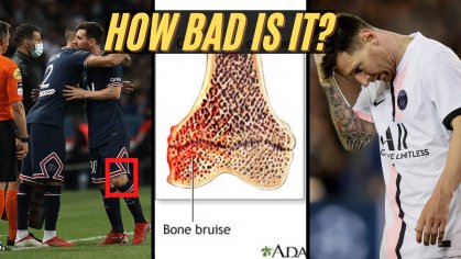 Expert Explains Lionel Messi Injury (knee 
