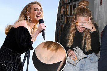 Adele appears to be removing her back tattoo