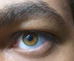 Amber Eyes (Pictures, Genetics & Facts) - Vision Center