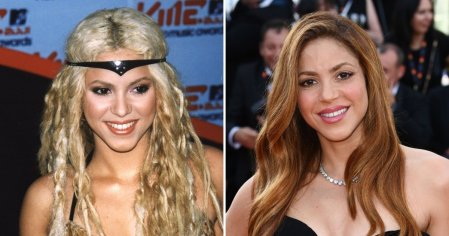 Did Shakira Get Plastic Surgery? Transformation Photos, Quotes