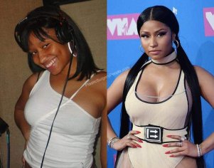 Did Nicki Minaj Get Breast & Butt Implants?