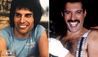 How Freddie Mercury Looks Like If He Would Fix His Teeth, Here's The Answer! - Metalhead Zone