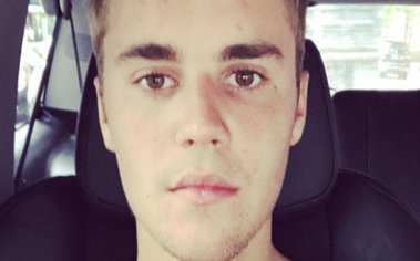 Justin Bieber's seriously wierd AF Instagram for his eye is TMI