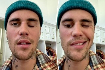 Justin Bieber's face paralyzed after rare disorder diagnosis